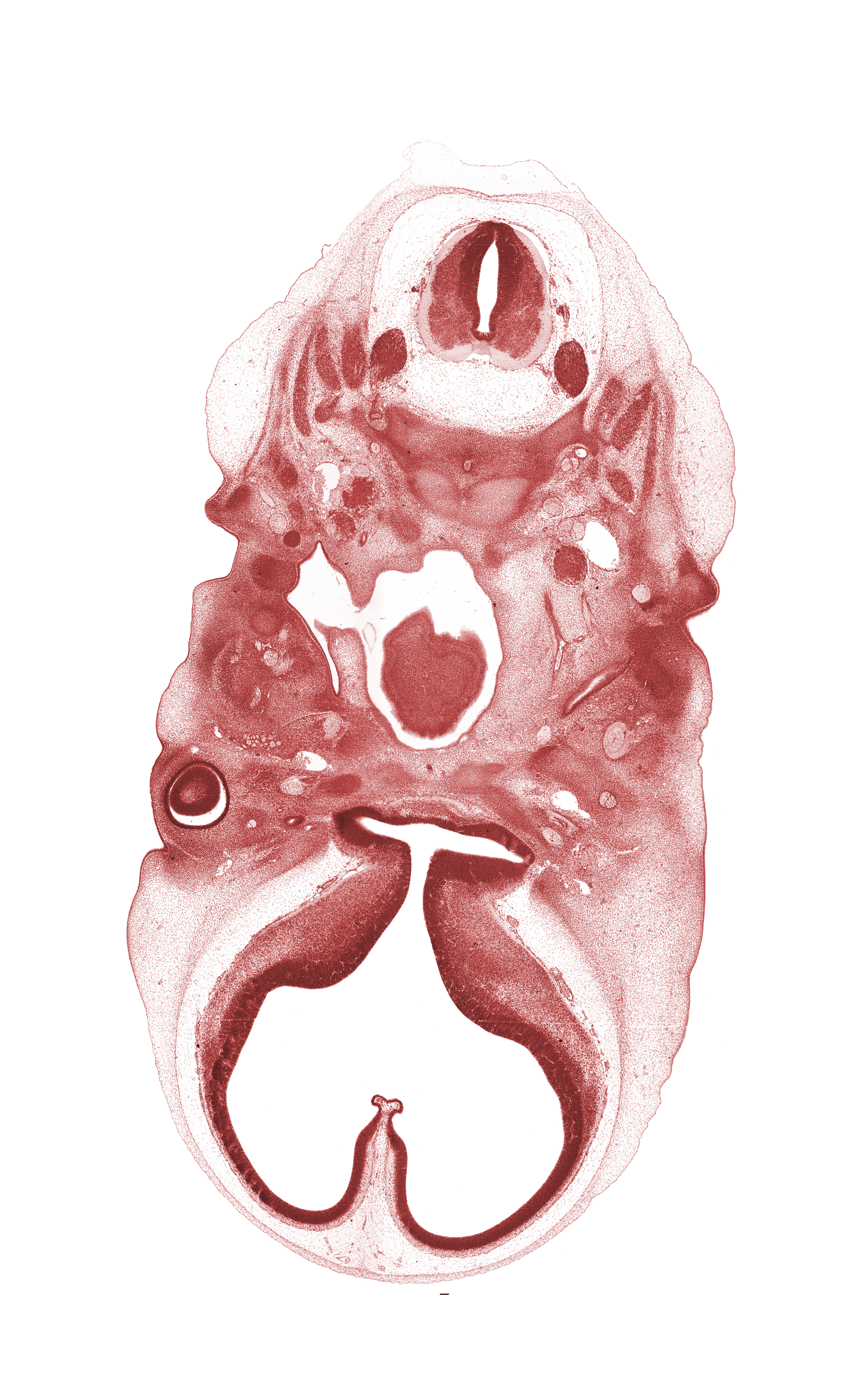 C-1 spinal nerve, C-1 vertebra (atlas), C-2 spinal ganglion, C-2 ventral root, atlanto-occipital joint, auricle, basi-occipital (basal plate), dens of C-2 vertebra (axis) region, edge of tongue, facial nerve (CN VII), falx cerebri region, head mesenchyme, hippocampal thickening, interventricular foramen, lateral ventricle, nasopharynx, notochord, optic chiasma (chiasmatic plate), optic groove, optic stalk (CN II), optic ventricle, oropharynx, paraphysis, spinal accessory nerve (CN XI), stem of adenohypophysis, subarachnoid space, third ventricle, vertebral artery