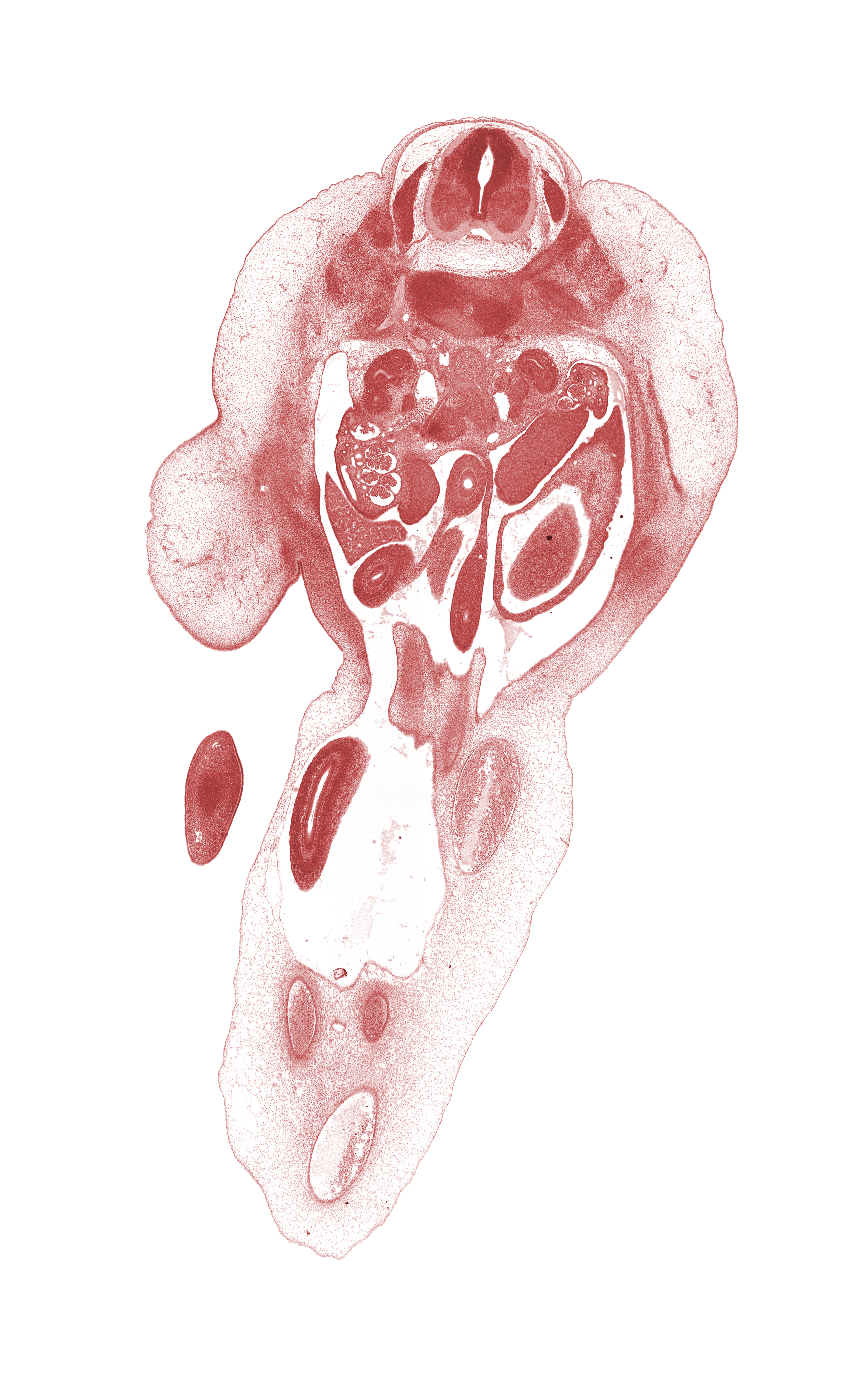 T-12 / L-1 intervertebral disc, T-12 spinal ganglion, allantois, amnion, caudal edge of stomach, dorsum of foot, duodenum (fourth part), edge of left umbilical artery, hindgut, inferior vena cava, left umbilical artery, lesser sac (omental bursa), mesonephros, mucoid connective tissue, ovary, proximal limb of herniated midgut, proximal limb of midgut, right umbilical artery, umbilical coelom, umbilical vein