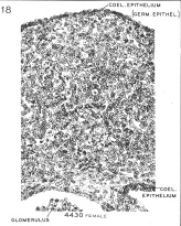 Coelomic epithelium