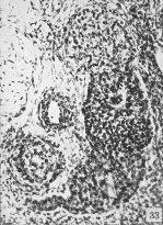 Transverse section of definitive thyroid gland