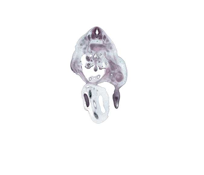 L-2 spinal ganglion, L-2 spinal nerve, allantois, aortic bifurcation, blastemata of anterior thigh muscles, dorsal root(s), dorsum of foot plate, edge of left umbilical artery, edge of proximal limb of herniated midgut, external iliac vessels, head of femur, hindgut, inferior pole of right kidney (metanephros), inferior vena cava, left umbilical artery, lumbar plexus, marginal vein, mesonephric duct, right umbilical artery, sympathetic trunk, umbilical coelom, umbilical vein, ureter, urinary bladder, ventral root