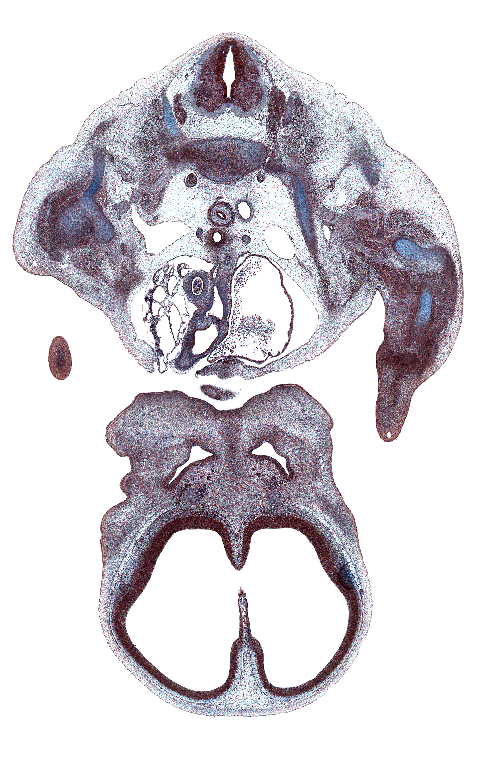 C-7 / T-1 intervertebral disc, T-1 intercostal nerve, T-1 spinal ganglion, T-1 spinal nerve, artifact(s), ascending aorta, centrum of T-1 vertebra, cerebral vesicle (telencephalon), edge of chin, edge of interventricular foramen, frontal prominence, hippocampus, humerus, infundibulum of right ventricle, lamina terminalis, lateral ventricle, left atrium, left pulmonary artery, maxillary prominence of pharyngeal arch 1, olfactory filia (CN I), olfactory placode, pericardial cavity, primary palate, pulmonary semilunar valve, pulmonary trunk, right subclavian artery, right subclavian vein, scapula, shaft of rib 1, superior vena cava, sympathetic trunk, vagus nerve (CN X)