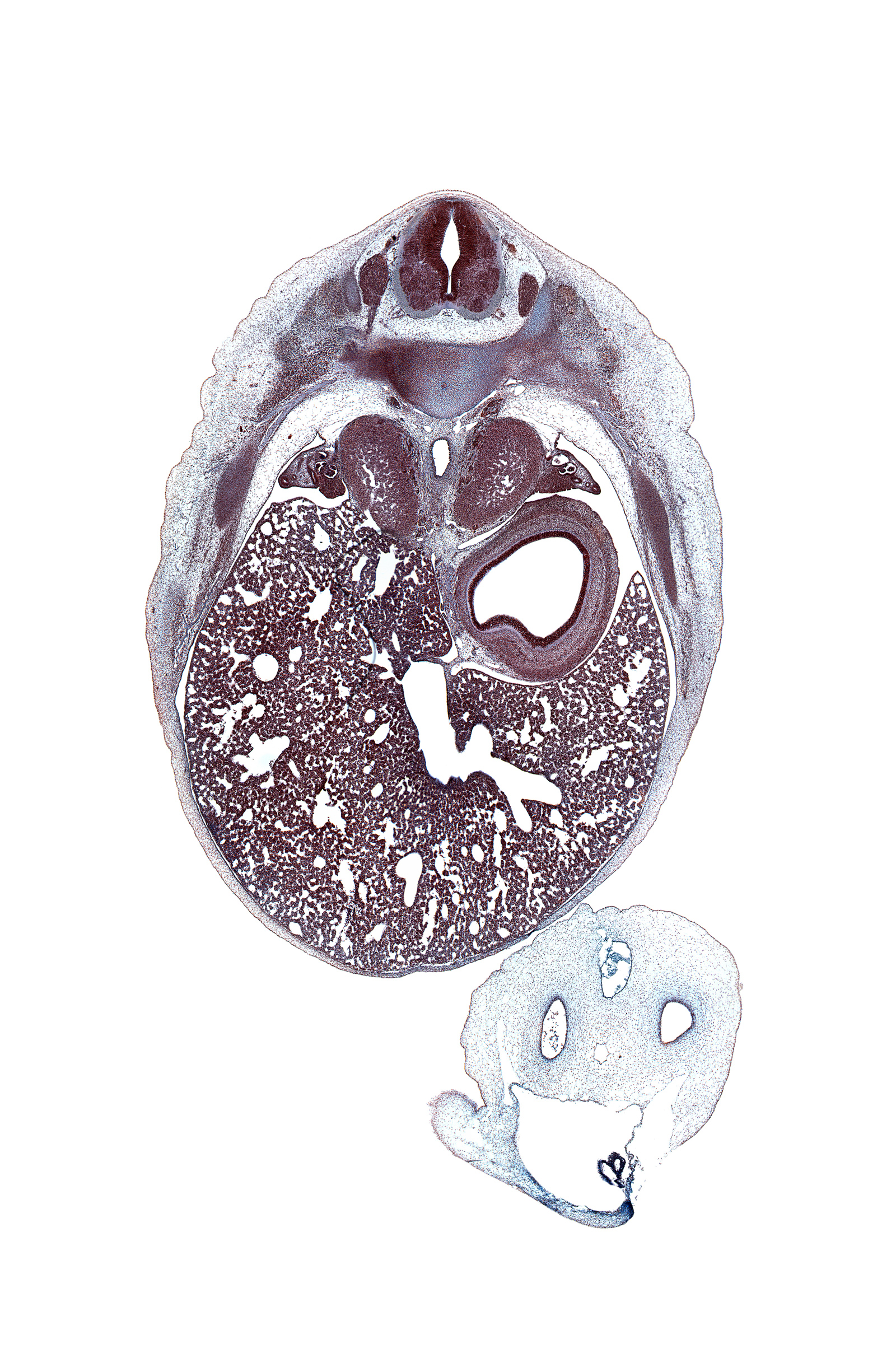 T-8 spinal ganglion, aorta, artifact(s), celiac ganglion, dorsal mesogastrium, ductus venosus, iliocostalis muscle, inferior vena cava, latissimus dorsi muscle, left umbilical artery, liver prominence, longissimus muscle, lumen of body of stomach, lumen of pyloric antrum of stomach, neural arch, osteogenic layer, rib 9, right lobe of liver, right umbilical artery, spinalis muscle, suprarenal gland cortex, suprarenal gland medulla, sympathetic trunk, umbilical coelom, umbilical vein