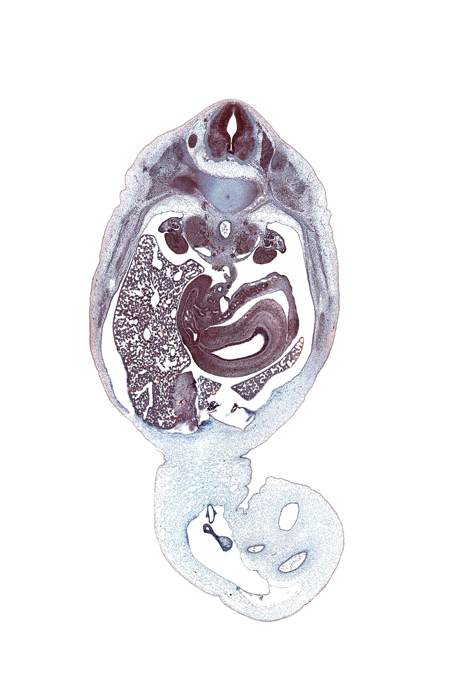 T-11 intercostal nerve, T-11 spinal ganglion, aorta, body of pancreas, central canal, common bile duct, duodenum (first part), duodenum (second part), gall bladder bed, gonad, hepatic portal vein, inferior vena cava, junction of ductus venosus and umbilical vein, left lobe of liver, left umbilical artery, lumen of pyloric antrum of stomach, omphalomesenteric vessels, pancreatic duct, pedicle of T-11 vertebra, peritoneal cavity, quadrate lobe of liver, right lobe of liver, right umbilical artery, superior mesenteric artery, superior pole of left kidney (metanephros), suprarenal gland cortex, suprarenal gland medulla, sympathetic trunk, umbilical coelom, umbilical vein