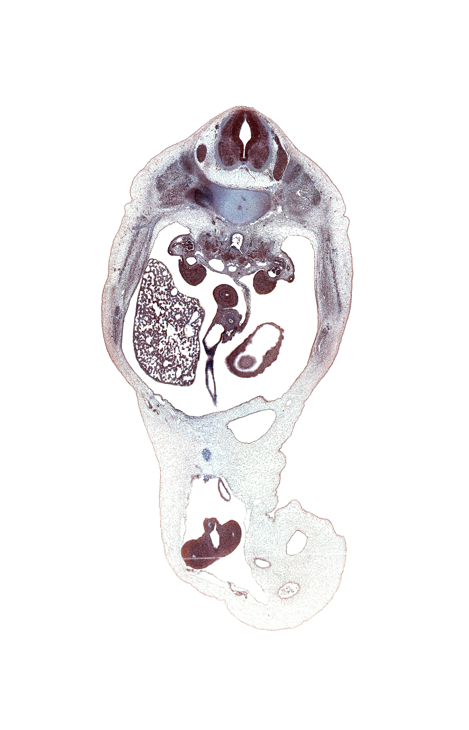 T-12 spinal ganglion, aorta, artifact(s), azygos vein anastomosis, caudal edge of lesser sac (omental bursa), caudal edge of stomach wall, centrum of T-12 vertebra, distal limb of herniated midgut, duodenum, gonad, inferior vena cava, left renal artery, left umbilical artery, mesentery, mesonephric duct, notochord, proximal limb of herniated midgut, right kidney (metanephros), right lobe of liver, right umbilical artery, superior mesenteric artery, superior mesenteric vein, umbilical vein