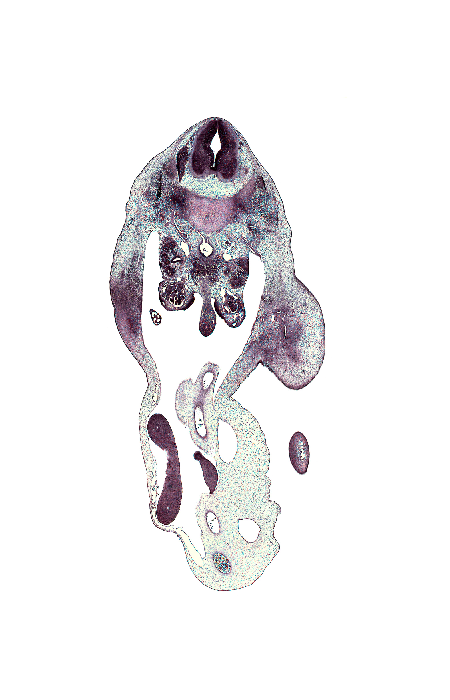 L-2 spinal ganglion, allantois, blastemata of lower abdominal wall muscles, blastemata of psoas major and quadratus lumborum muscles, caudal edge of right lobe of liver, centrum of L-2 vertebra, cephalic edge of left foot plate, edge of distal limb of herniated midgut, gonad, hindgut, iliocostalis muscle, kidney (metanephros), left umbilical artery, longissimus muscle, mesonephric duct, neural arch of L-2 vertebra, peritoneal cavity, proximal limb of herniated midgut, right umbilical artery, spinalis muscle, umbilical coelom, umbilical vein, ureter