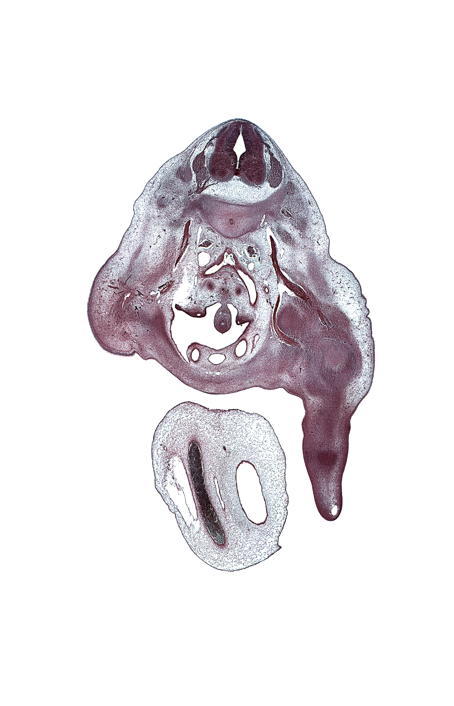 L-3 dorsal root, L-3 spinal ganglion, L-3 ventral root, allantois, aortic bifurcation, central canal, centrum of L-3 vertebra, external iliac artery, femoral nerve, gubernaculum of gonad, hindgut, inferior vena cava, left common iliac artery, left umbilical artery, mesonephric duct, obturator nerve, plantar surface of foot plate, pubis, right umbilical artery, sympathetic trunk, umbilical coelom, umbilical cord, umbilical vein, ureter, urinary bladder