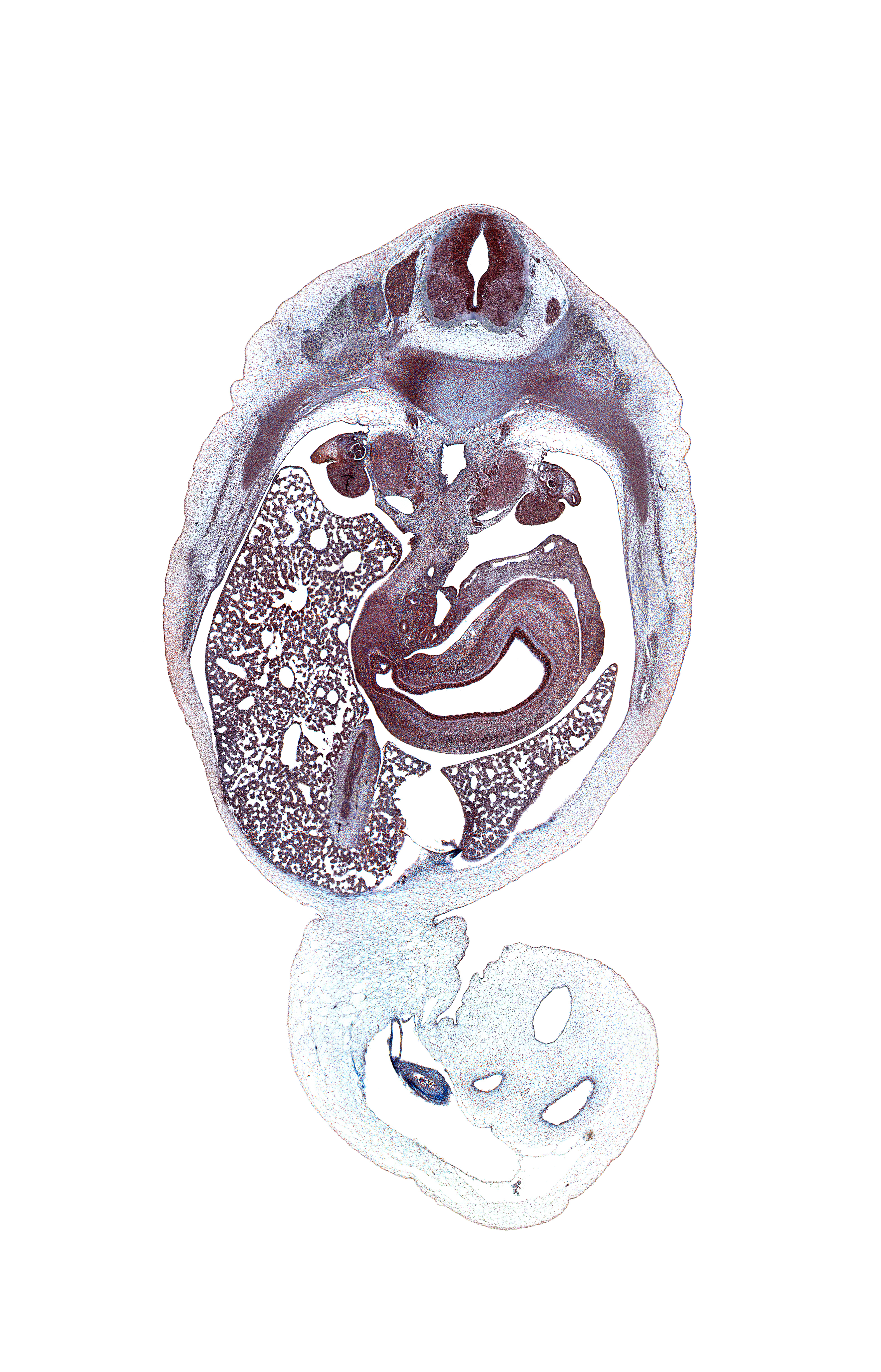 T-11 spinal ganglion, allantois, aorta, common bile duct, ductus venosus, gall bladder, gonad, hepatic portal vein, iliocostalis muscle, inferior vena cava, left lobe of liver, left umbilical artery, lesser splanchnic nerve, longissimus muscle, lumen of body of stomach, lumen of pyloric antrum of stomach, mesonephric duct, mesonephros, omphalomesenteric vessels, quadrate lobe of liver, rib 11, right lobe of liver, right umbilical artery, spinalis muscle, splenic vein, superior mesenteric artery, suprarenal gland medulla, sympathetic trunk, umbilical coelom, umbilical vein