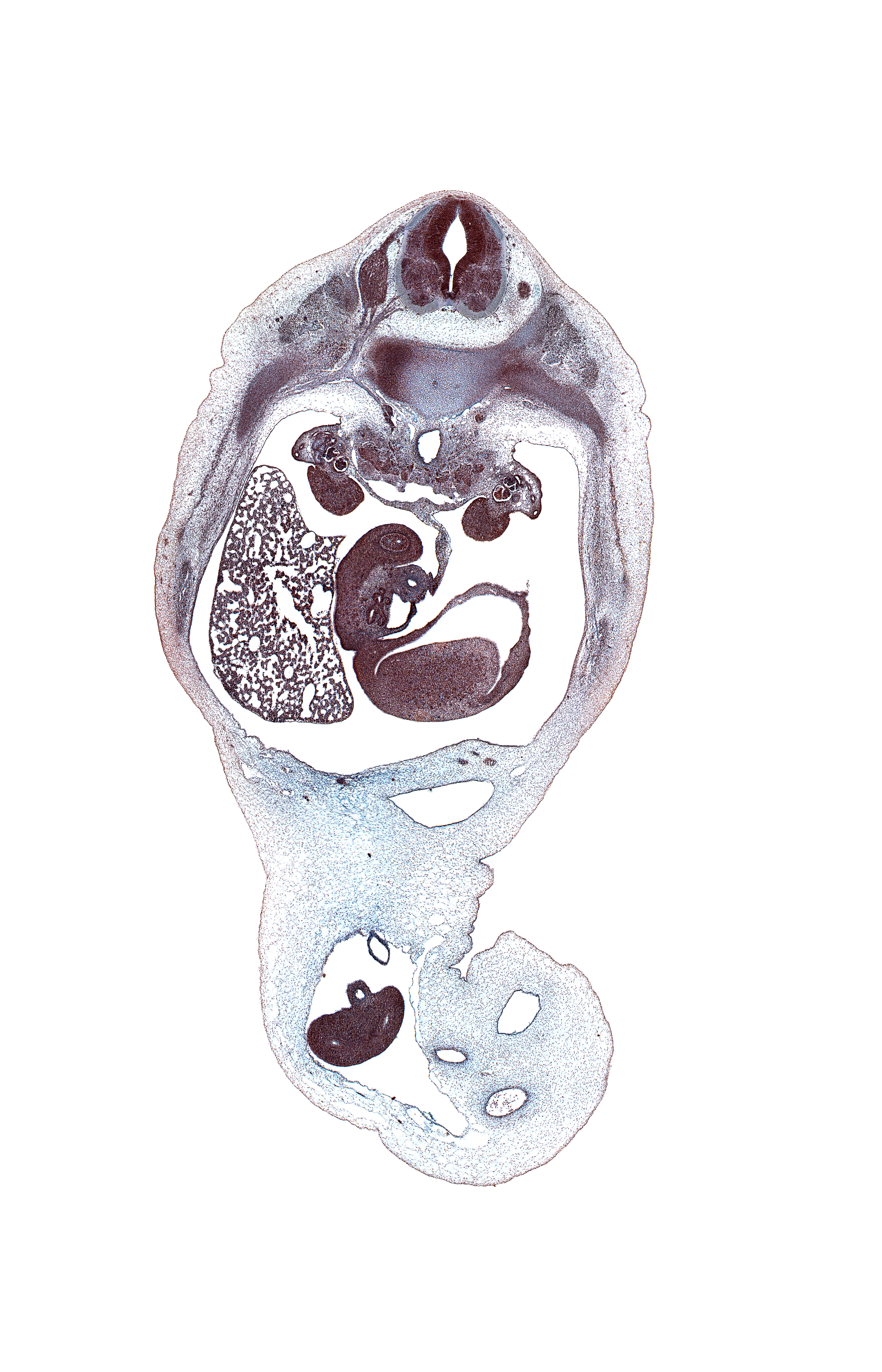 T-11 / T-12 intervertebral disc, T-12 spinal ganglion, aorta, central canal, distal limb of herniated midgut, dorsal mesogastrium, dorsal root(s), duodenum (second part), glomerulus in mesonephros, gonad, inferior vena cava, least splanchnic nerve, left subcardinal anastomosis, left umbilical artery, lesser sac (omental bursa), mesonephric duct, peritoneal cavity, proximal limb of herniated midgut, ramus communicans, rib 12, right lobe of liver, right umbilical artery, superior mesenteric artery, superior mesenteric vein, superior pole of left kidney (metanephros), sympathetic trunk, umbilical coelom, umbilical vein, ventral root, wall of stomach