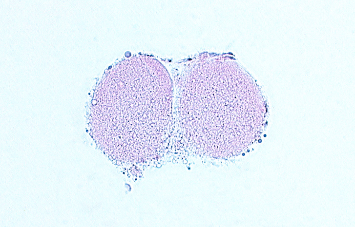 blastomere cytoplasm, cleavage plane, polar body, zona pellucida