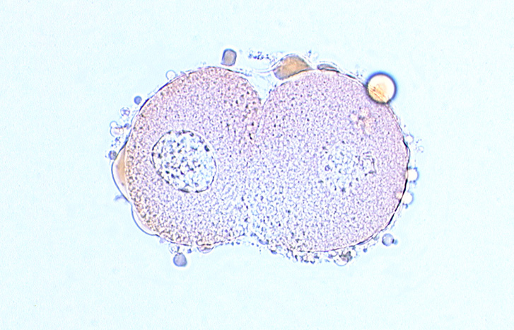 blastomere cytoplasm, blastomere nucleus, contiguous cell membranes, edge of nucleus, zona pellucida