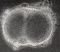 Intact ovum photographed by phase microscopy