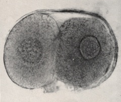 Intact ovum photographed by ordinary microscopy