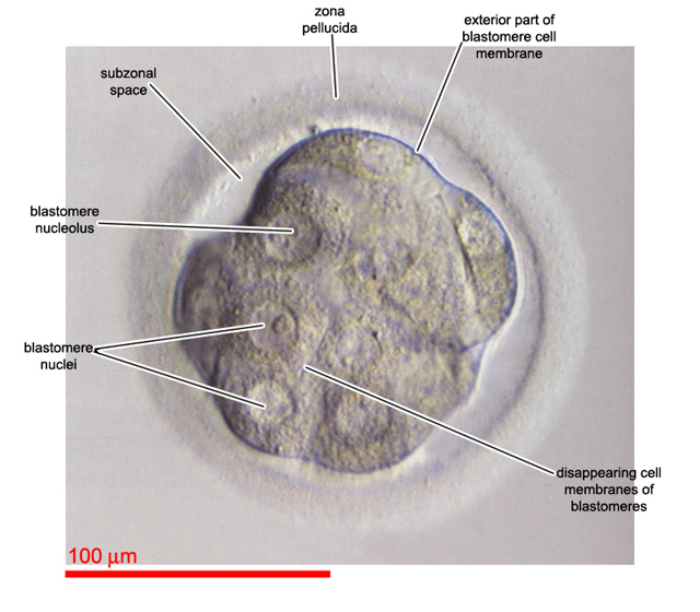 Disappearing cell membranes in a compacting embryo