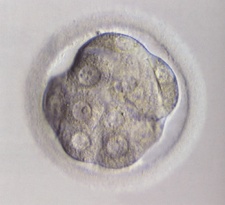 Disappearing cell membranes in a compacting embryo