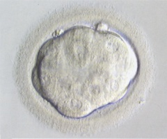 Final phase of compaction in an embryo