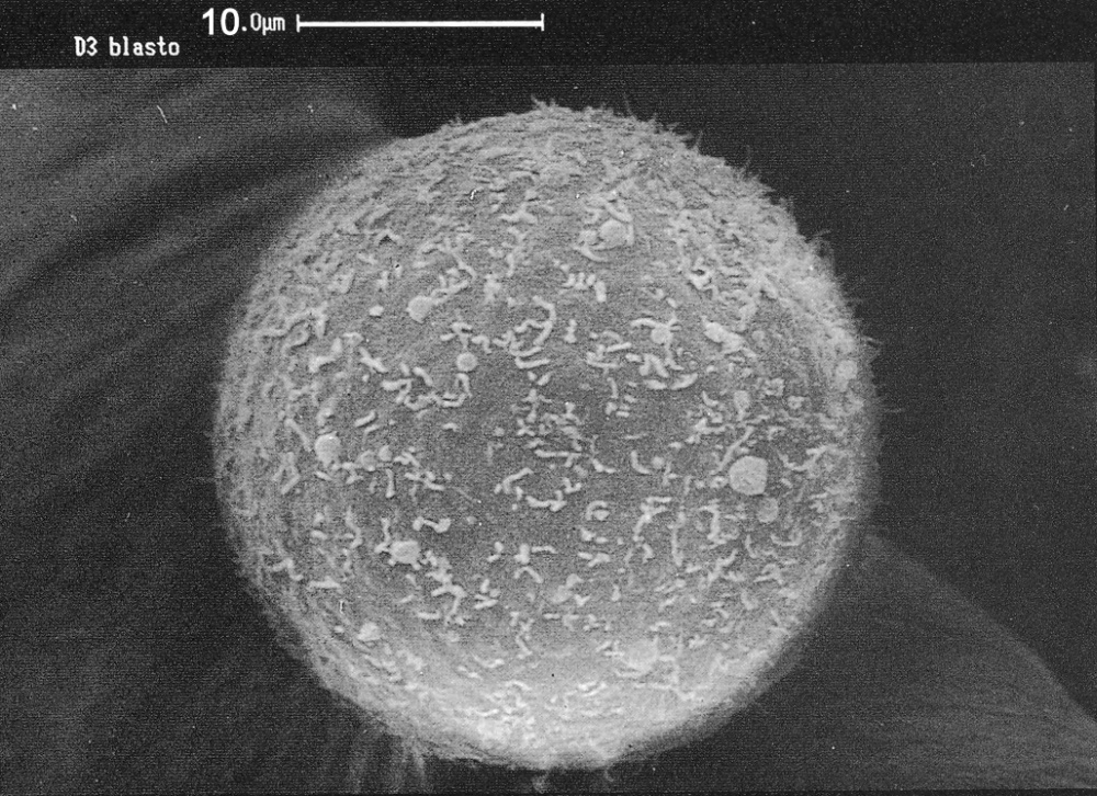 Single blastomere from a 7-cell embryo