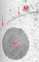 Nuclear membrane and nucleolus of a 2-cell embryo