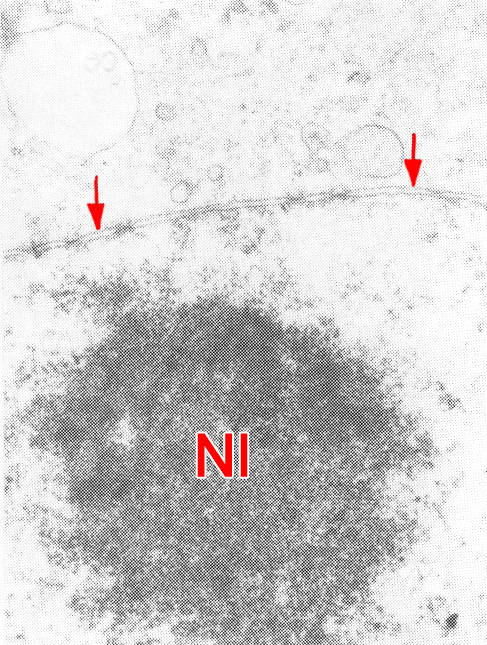 Blebbing absence of the nuclear membrane of a 16-cell embryo