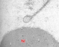 Dense granular material inside nucleolus of a 4-cell embryo