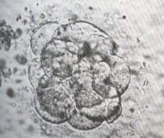 Morula at the beginning of compaction