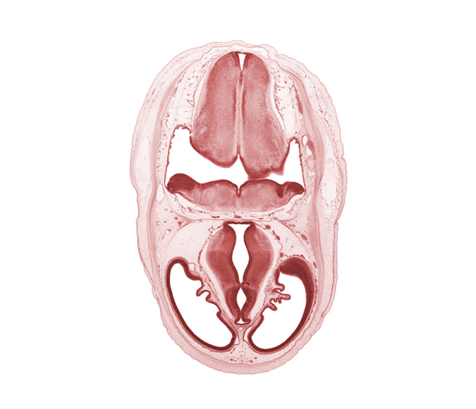 artifact separation(s), cerebral vesicle (telencephalon), choroid plexus, dorsal thalamus, dural band for tentorium cerebelli, endolymphatic sac, hypothalamic sulcus, hypothalamus, marginal ridge, myelencephalon (medulla oblongata), obex, posterior dural venous plexus, primordial sigmoid sinus, roof of diencephalon, vascular plexus, ventral thalamus