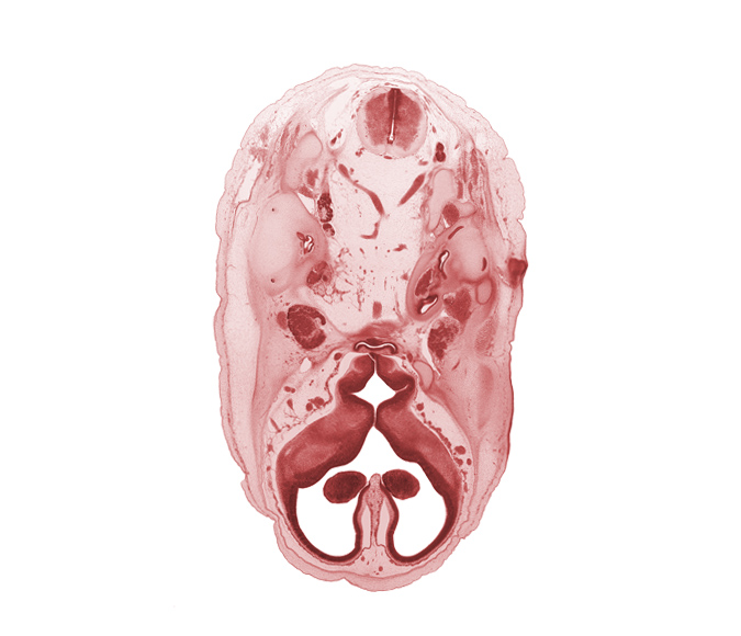 C-1 spinal ganglion, abducens nerve (CN VI), accessory nerve (CN XI), artifact separation(s), auricle, cochlear duct, dorsum sellae region, falx cerebri region, foramen magnum region, hypoglossal nerve (CN XII), hypothalamus, internal carotid artery, internal jugular vein, interventricular foramen, ophthalmic nerve (CN V₁), optic groove, orbitosphenoid, primary head vein, spinal accessory nerve (CN XI), spinal cord, subarachnoid space, third ventricle, trigeminal ganglion (CN V), vagus nerve (CN X), venous plexus(es), vertebral artery