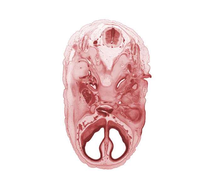 C-1 spinal ganglion, anterior cerebral artery, anterior spinal artery, artifact separation(s), basi-occipital (basal plate), central canal, cerebral vessels, edge of adenohypophysis, edge of third ventricle, hypoglossal canal, hypoglossal nerve (CN XII), internal carotid artery, internal jugular vein, mandibular nerve (CN V₃), maxillary nerve (CN V₂), ophthalmic nerve (CN V₁), optic chiasma (chiasmatic plate), pharyngeal arch 1 cartilage (Meckel), pharyngeal arch 2 cartilage, subarachnoid space, vagus nerve (CN X), vertebral artery