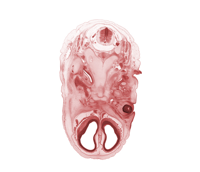 C-2 spinal ganglion, accessory nerve (CN XI), anterior cerebral artery, artifact separation(s), basi-occipital (basal plate), cochlear duct, cornea, edge of pharyngotympanic tube, facial nerve (CN VII), glossopharyngeal nerve (CN IX), hypoglossal canal, hypoglossal nerve (CN XII), internal jugular vein, lateral ventricle, lower eyelid, mandibular nerve (CN V₃), orbitosphenoid, retina, spinal accessory nerve (CN XI), subarachnoid space, upper eyelid, vagus nerve (CN X)