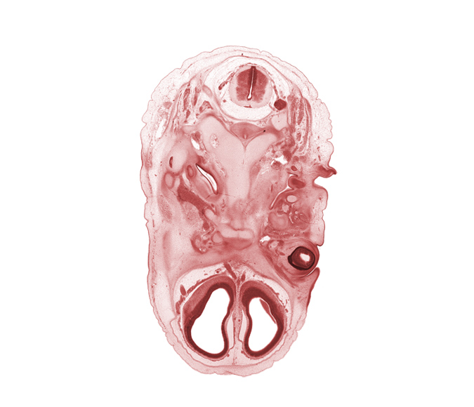 C-2 spinal ganglion, accessory nerve (CN XI), anterior cerebral artery, artifact separation(s), basi-occipital (basal plate), basisphenoid, cochlear duct, external acoustic meatus, facial nerve (CN VII), falx cerebri region, hypoglossal canal, hypoglossal nerve (CN XII), inferior ganglion of glossopharyngeal nerve (CN IX), intermediate zone, internal jugular vein, malleus cartilage, marginal zone, maxillary nerve (CN V₂), optic nerve (CN II), pharyngotympanic tube, spinal accessory nerve (CN XI), subarachnoid space, vagus nerve (CN X), ventricular zone