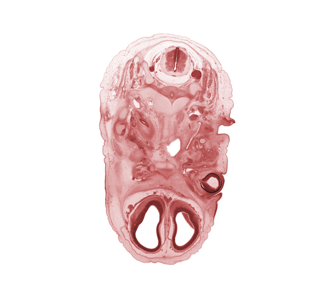 C-2 dorsal root, C-2 spinal ganglion, anterior communicating artery, artifact separation(s), atlanto-occipital joint, basi-occipital (basal plate), basisphenoid, dens of C-2 vertebra (axis), edge of cochlear duct, edge of pharynx, facial nerve (CN VII), hypoglossal nerve (CN XII), inferior ganglion of glossopharyngeal nerve (CN IX), internal jugular vein, lateral ventricle, malleus cartilage, maxillary nerve (CN V₂), maxillary vein, olfactory bulb, optic nerve (CN II), osteogenic layer, semispinalis cervicis muscle, upper eyelid, vagus nerve (CN X), vertebral artery