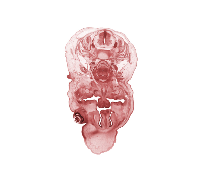 C-5 spinal ganglion, body of hyoid (pharyngeal arch 3 cartilage), body of tongue, cornea, dorsal horn of grey matter, frontal prominence, geniohyoid muscle, hypoglossal nerve (CN XII), inferior ganglion of vagus nerve (CN X), internal carotid artery, internal jugular vein, jugular lymph sac, middle cervical sympathetic ganglion, nasal capsule, nasal cavity (nasal sac), nasal septal cartilage, palatine shelf, pharyngeal arch 1 cartilage (Meckel), platysma muscle, ventral horn of grey matter, vertebral artery