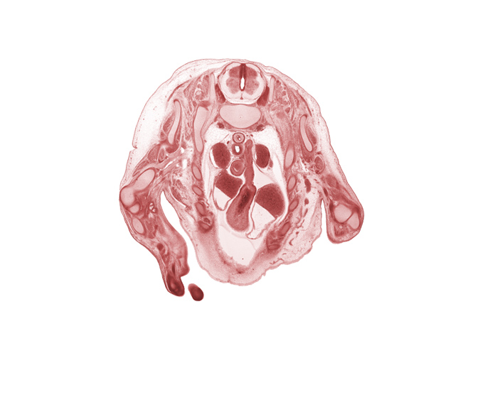 T-1 spinal ganglion, T-1 spinal nerve, aorta, ascending aorta, capitulum of humerus, ductus arteriosus, esophagus, head of radius, infundibulum of right ventricle, left atrium, pericardial cavity, pulmonary semilunar valve, pulmonary trunk, rib 2, right atrium, right ventricle, scapula, superior vena cava, sympathetic trunk, trachea, ulna