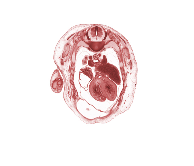 aortic vestibule, cephalic edge of liver, infundibulum of right ventricle, left atrium, pericardial cavity, peritoneal cavity, pleural cavity, primary bronchus, rib 3, rib 4, right atrium, sympathetic trunk, upper lobe of right lung