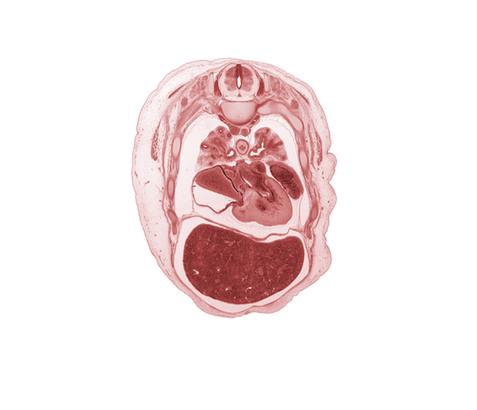 T-4 spinal ganglion, anterior segmental bronchus, azygos vein, foramen ovale, head of rib 5, latissimus dorsi muscle, left atrium, left lobe of liver, lower secondary bronchus, middle secondary bronchus, posterior segmental bronchus, primary interatrial septum (septum primum), rib 6, right atrium, right lobe of liver, secondary interatrial septum (septum secundum), serratus anterior muscle, trapezius muscle, upper secondary bronchus