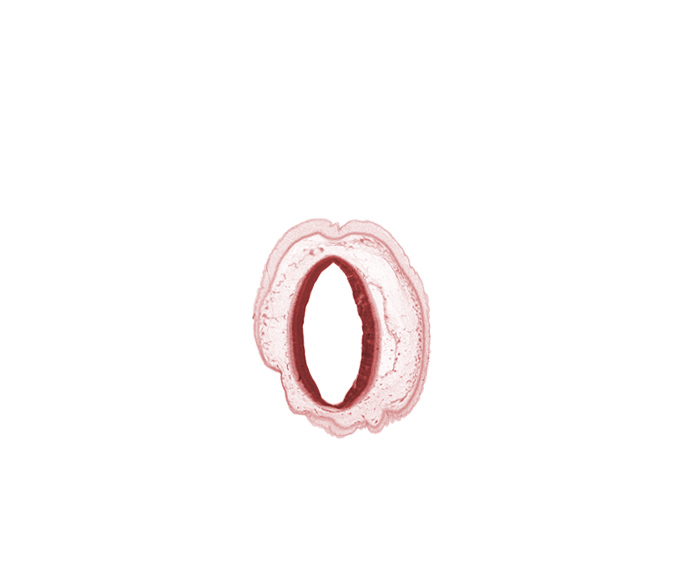 artifact separation(s), cerebral aqueduct (mesencoel), intermediate zone, marginal zone, osteogenic layer, roof plate of mesencephalon, tectum of mesencephalon, ventricular zone