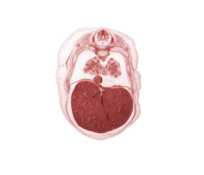 T-6 dorsal root, T-6 spinal ganglion, aorta, dorsal meso-esophagus, head of rib 7