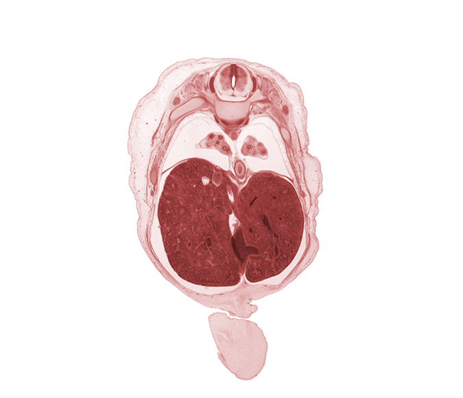 T-8 intercostal nerve, T-8 spinal ganglion, T-8 spinal nerve, afferent hepatic vein, amnion on surface of umbilical cord, azygos vein, diaphragm, ductus venosus, esophagus endoderm, falciform ligament, inferior vena cava (hepatic part), left lobe of liver, lower lobe of left lung, lower lobe of right lung, pleural cavity, rib 9, right lobe of liver, sympathetic trunk