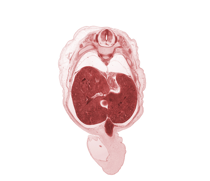 T-9 spinal ganglion, T-9 spinal nerve, afferent hepatic vein, aorta, edge of herniated midgut, edge of pyloric antrum of stomach, esophageal hiatus in diaphragm, esophagus, greater splanchnic nerve, hepatic portal vein, inferior vena cava (hepatic part), left lobe of liver, peritoneal cavity, pleural cavity, rib 10, sympathetic trunk, umbilical coelom, umbilical cord, umbilical vein