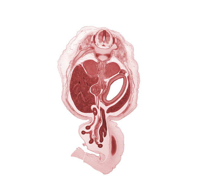 T-11 / T-12 intervertebral disc, T-11 spinal ganglion, T-11 ventral root, aorta, celiac artery, celiac plexus, central canal, descending part of duodenum (second part), distal limb of herniated midgut, dorsal funiculus, jejunum, lateral funiculus, left lobe of liver, mesocolon, midpoint of herniated midgut, proximal limb of herniated midgut, right lobe of liver, superior mesenteric artery, suprarenal gland cortex, suprarenal gland medulla, testis, umbilical vein, ventral funiculus, ventral mesogastrium