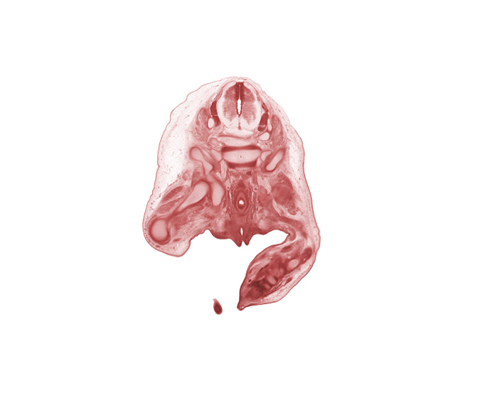 L-4 spinal ganglion, L-5 / S-1 intervertebral disc, L-5 spinal ganglion, L-5 spinal nerve, S-1 / S-2 intervertebral region, S-1 spinal nerve, ala of sacrum, cephalic edge of right foot, fibula, ilium, ischium, levator ani muscle, marginal vein, rectum, sacral plexus, sciatic nerve, scrotal swelling, subarachnoid space, tarsal cartilage(s), urethra, urethral fold, urethral groove