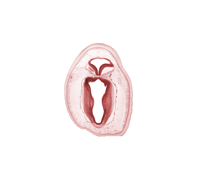 artifact separation(s), commissure of superior colliculus, mesencephalon, metencephalon, osteogenic layer, roof of rhombencoel (fourth ventricle), root of trochlear nerve (CN IV), tectum, tegmentum