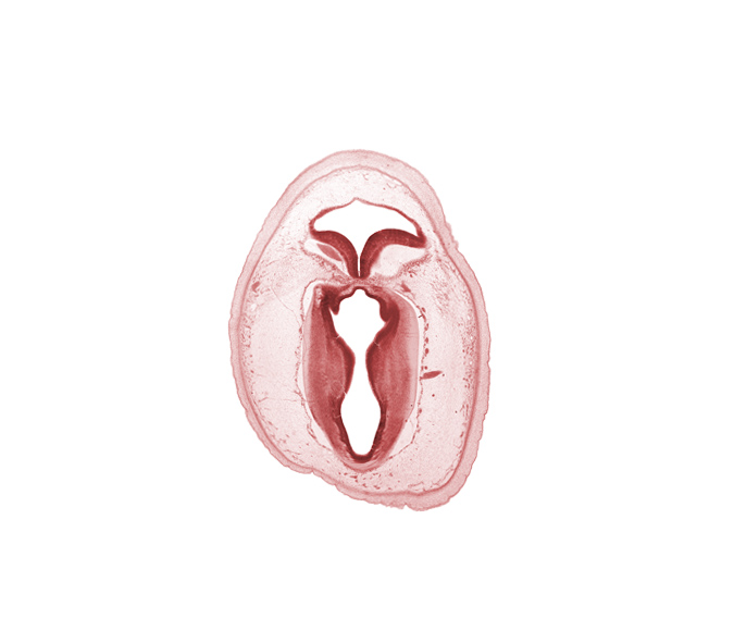 artifact separation(s), cerebral aqueduct (mesocoele), commissure of superior colliculus, intermediate zone, junction of mesencephalon and metencephalon, marginal zone, rhombencoel (fourth ventricle), root of trochlear nerve (CN IV), subarachnoid space, vascular plexus, ventricular zone