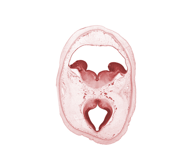 artifact separation(s), external cerebellum, internal cerebellum, median sulcus, mesencephalon, oculomotor nerve (CN III), pons region (metencephalon), rhombencoel (fourth ventricle), roof of rhombencoel (fourth ventricle), roof plate of mesencephalon, subarachnoid space, sulcus limitans, tectum, tegmentum, trochlear nerve (CN IV)