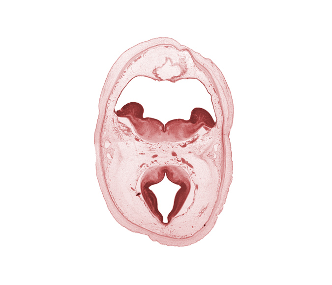 alar plate of metencephalon (cerebellum), artifact separation(s), basal plate, diverticulum of rhombencoel (fourth ventricle), dorsal thalamus, floor plate, hypothalamic sulcus, oculomotor nerve (CN III), osteogenic layer, posterior cerebral artery, roof of rhombencoel (fourth ventricle), roof plate, subarachnoid space, sulcus limitans, superior cerebellar artery, trochlear nerve (CN IV)