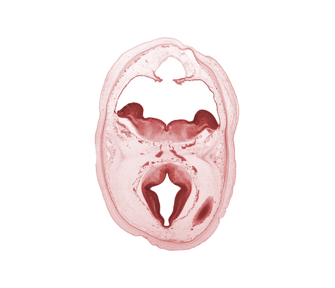 artifact separation(s), diverticulum of rhombencoel (fourth ventricle), dorsal thalamus, dural band for tentorium cerebelli, edge of cerebral vesicle(s), hypothalamic sulcus, hypothalamus, metencephalon, osteogenic layer, posterior cerebral artery, primordial transverse sinus, rhombencoel (fourth ventricle), subarachnoid space, sulcus dorsalis, sulcus limitans, surface ectoderm, third ventricle, venous plexus(es)