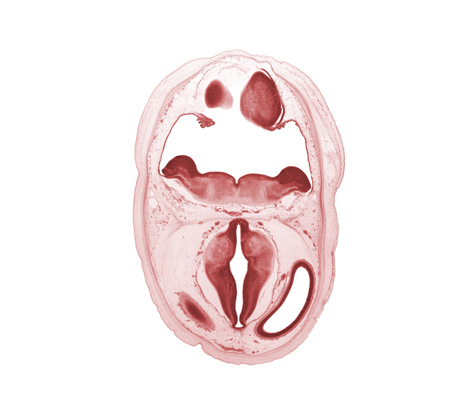 alar plate of myelencephalon, artifact separation(s), basilar artery, choroid plexus, dorsal thalamus, edge of cerebral vesicle(s), hypothalamic sulcus, hypothalamus, metencephalon, osteogenic layer, posterior communicating artery, rhombencoel (fourth ventricle), roof plate, surface ectoderm