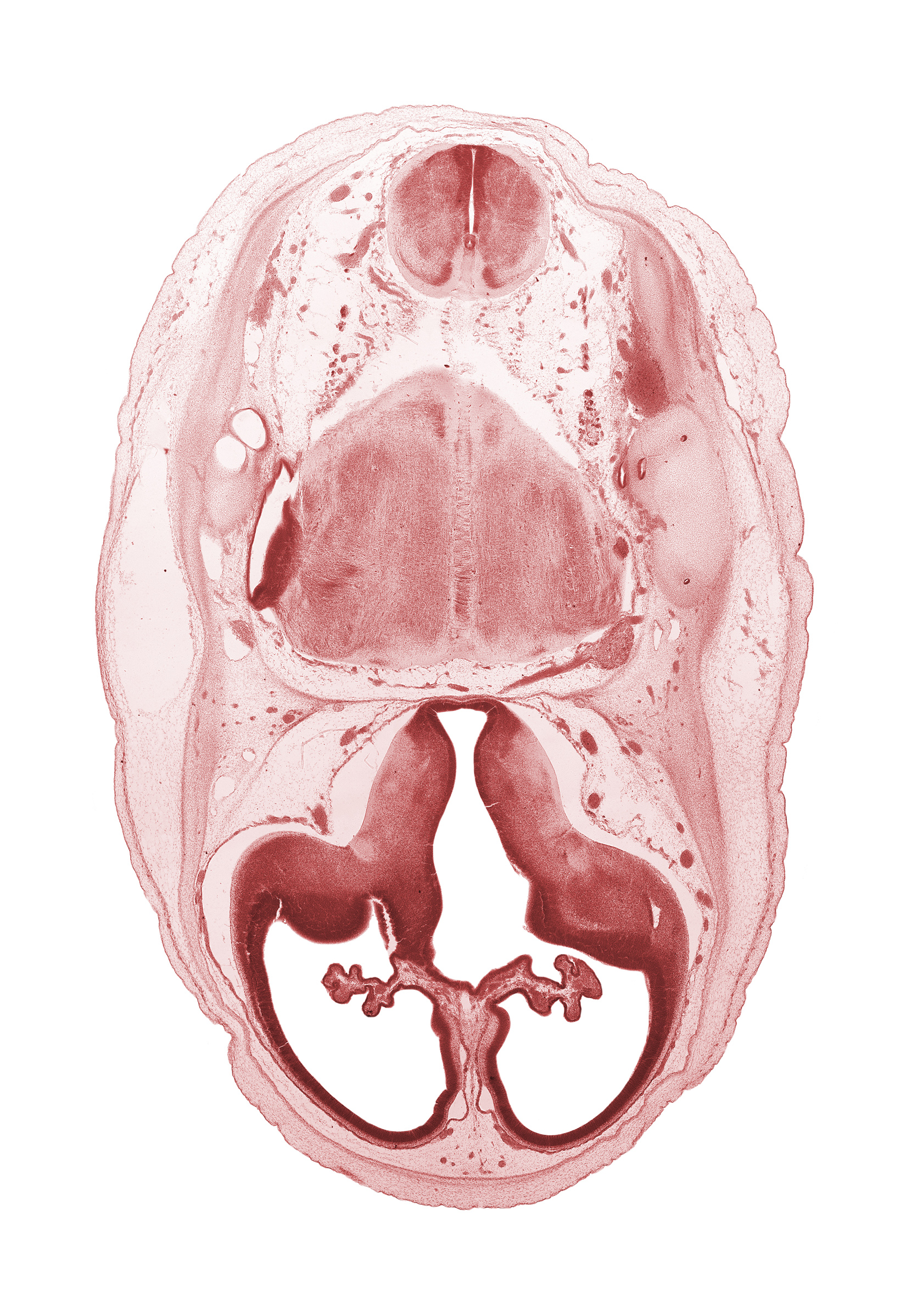 artifact separation(s), endolymphatic duct, internal carotid artery, lateral ventricle, lateral ventricular eminence (telencephalon), medial accessory olivary nucleus, medial ventricular eminence (diencephalon), myelencephalon (medulla oblongata), posterior communicating artery, pyramidal tract region, root of accessory nerve (CN XI), root of trigeminal nerve (CN V), third ventricle