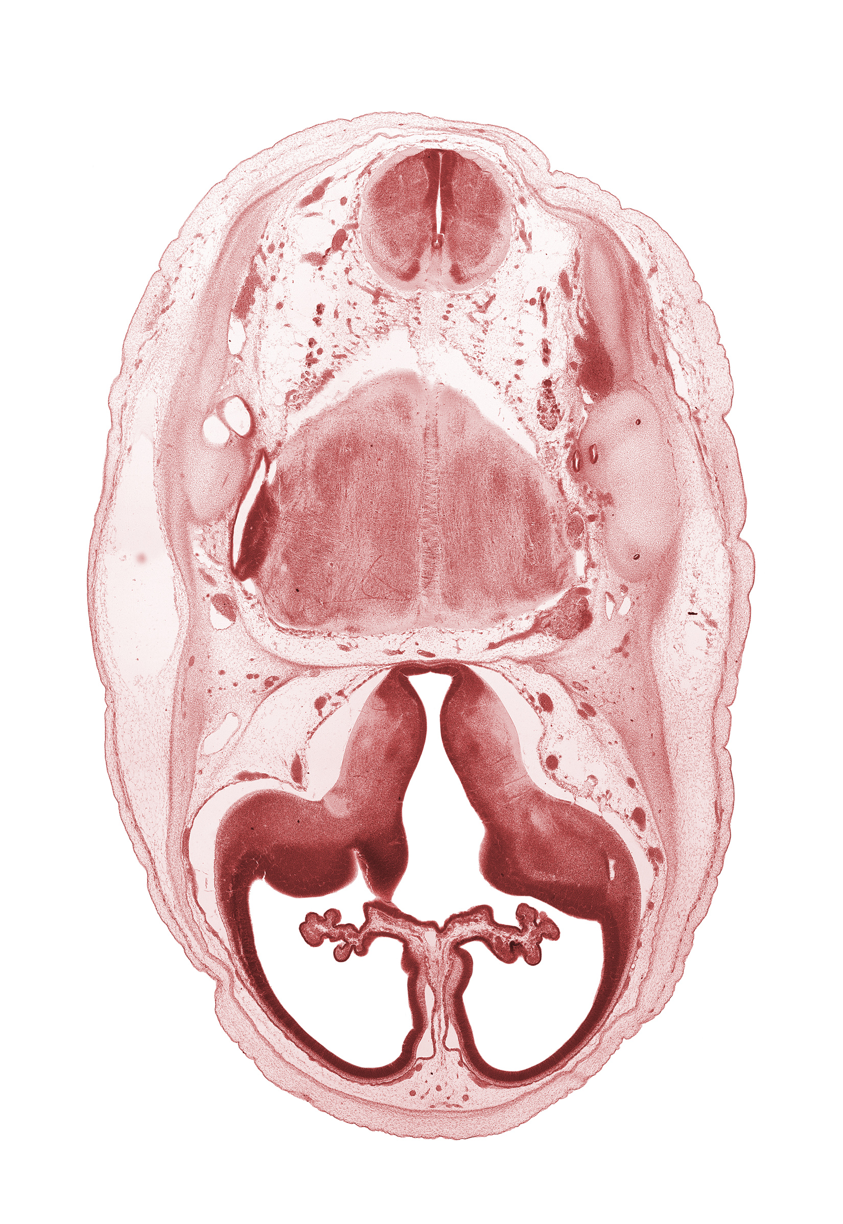artifact separation(s), edge of lateral recess of rhombencoel (fourth ventricle), falx cerebri region, hypothalamic sulcus, internal carotid artery, interventricular foramen, lateral recess of rhombencoel (fourth ventricle), lateral ventricular eminence (telencephalon), medial ventricular eminence (diencephalon), myelencephalon (medulla oblongata), pons region (metencephalon), pyramidal tract region, root of accessory nerve (CN XI), root of glossopharyngeal nerve (CN IX), sigmoid sinus, vagus nerve (CN X)