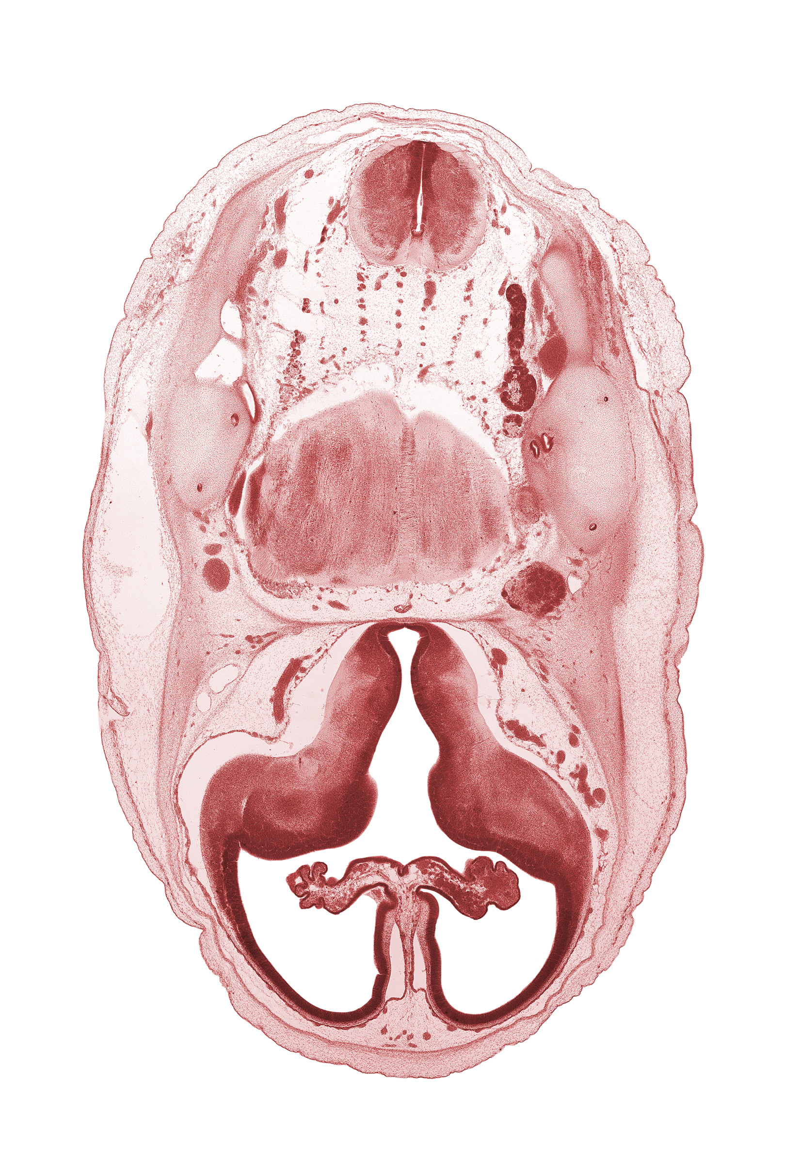 anterior semicircular duct, artifact separation(s), basilar artery, choroid plexus, edge of lateral recess of rhombencoel (fourth ventricle), fasciculus cuneatus, fasciculus gracilis, hypothalamic sulcus, hypothalamus, internal carotid artery, internal jugular vein, junction of internal carotid and posterior communicating arteries, lateral ventricular eminence (telencephalon), medial ventricular eminence (diencephalon), motor root of trigeminal nerve (CN V), otic capsule cartilage, pyramidal tract region, root of hypoglossal nerve (CN XII), trigeminal ganglion (CN V)